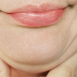 Double Chin? Ini Cara Menghilangkannya!