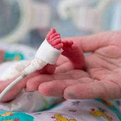 Merawat Bayi Prematur Agar Tumbuh Kembang Optimal