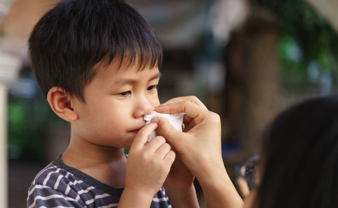 Penyebab Anak Sering Mimisan