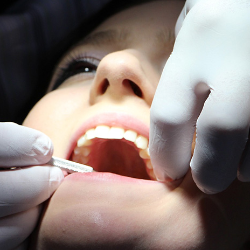 Kuis: Cek Pengetahuan Kamu Seputar Kesehatan Mulut!