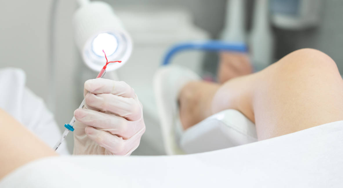 Bolehkan Pasang IUD Segera Setelah Melahirkan?