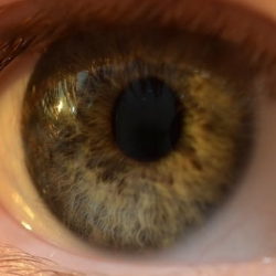 Ini Bahaya Lupa Melepas Lensa Kontak Sebelum Tidur