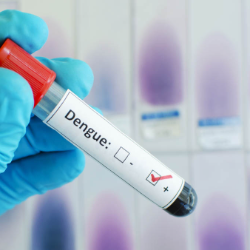 Kena DBD Kedua Kali Gejala Lebih Berat, Cegah dari Sekarang