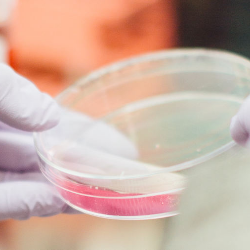 10 Tes Darah yang Wajib Dilakukan Untuk Mengetahui Kesehatan Tubuh