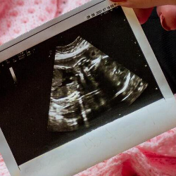 Deteksi Jabang Janin, Apa Artinya?