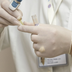 Peneliti Wanita asal Indonesia Temukan Pendeteksi Kanker Hati