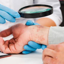 Dokter Spesialis Kulit Kelamin Berganti Menjadi Sp.DVE, Begini Penjelasannya!