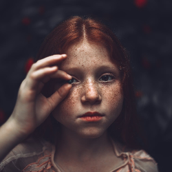 Jika Anak Terdiagnosis Epilepsi