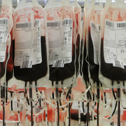 Donor Apheresis untuk Sambung Impian Anak Pejuang Kanker