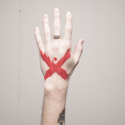 Ini Bahaya jika Suka Membunyikan Sendi!