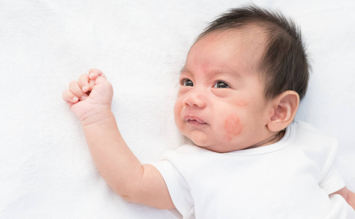 Kulit bayi nampak merah