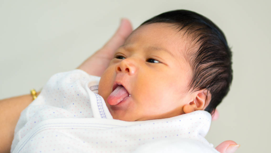 Tidak Selalu Berbahaya, Ini Penyebab Lidah Bayi Berwarna Putih.