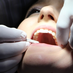 Penderita Diabetes Lebih Rentan Radang Gusi