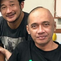 Agung Hercules Dikabarkan Idap Kanker Otak, Kenali Gejalanya!