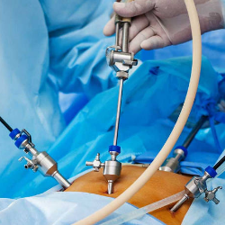 Jangan Terlambat Deteksi Kanker Usus Besar