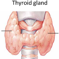 Gengs, Ketahui 7 Fakta Seputar Tiroid!