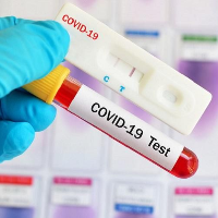 Apa itu Rapid Test COVID-19? Ini yang Perlu Kamu Tahu!