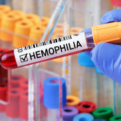 Hari Hemofilia Sedunia 2025, Akses Pengobatan Belum Merata