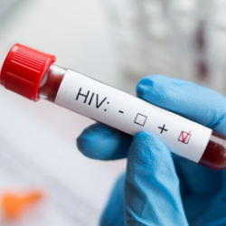 Ibu Rumah Tangga Banyak Tertular HIV, Anak Pun Bisa Jadi Korban