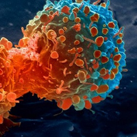 Infeksi Apa Saja yang Menyebabkan Kanker?