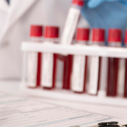 Deteksi Infeksi Cyromegalovirus (CMV) Sebelum dan Selama Hamil!