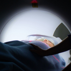 Awas, Terjadi Kenaikan Jumlah Penderita Kanker dari Kalangan Milenial!