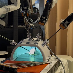 Sama-sama Bedah Minimal Invasif, Inilah Perbedaan Laparaskopi dengan Bedah Robotik