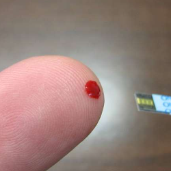 Mengukur Kadar Gula Darah Sewaktu, Berapa Nilai Normalnya?