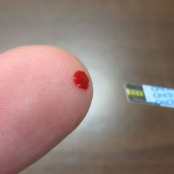 Gula Darah Sangat Tinggi Mencapai 400 mg/dL, Apa Bahayanya?