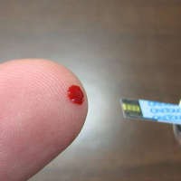 Kapan Waktu Terbaik untuk Mengecek Kadar Gula Darah?