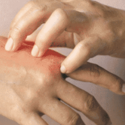 Kenapa Kulit Lebih Sensitif saat Hamil?