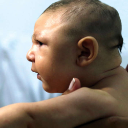 Kepala Bayi Berukuran Jauh Lebih Kecil, Apa Penyebabnya?