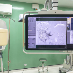 Keunggulan Metode DSA untuk Deteksi Kelainan Otak