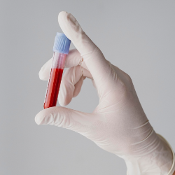 Kolesterol Tinggi saat Hamil, Bahaya?