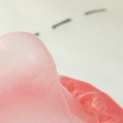 Kuis: Tes Pengetahuan Kamu Tentang Penyakit Menular Seksual!