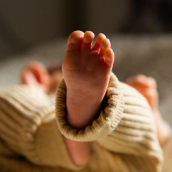 Kulit Bayi Mengelupas, Normalkah?