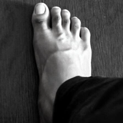 Kenapa Luka Diabetes Menghitam? Apakah Berbahaya?