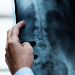 Dengan Teknologi, Kesalahan Diagnosis Bisa Dihindari