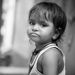 Waspada Marasmus, Malnutrisi Umum pada Balita Akibat Kurangnya Asupan Protein