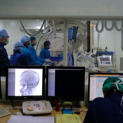 Mencegah Stroke Berulang dengan Intervensi Pembuluh Darah Karotid