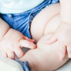 Kenali dan Kendalikan Alergi Susu Sapi pada Anak