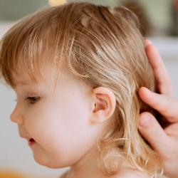 Duh, Si Kecil Berketombe? Begini Tips Mengatasinya!