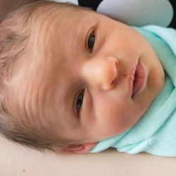 Mengenal Seputar GERD pada Bayi