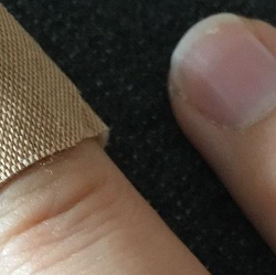 Mengupas Mitos dan Fakta Cara Membersihkan Luka