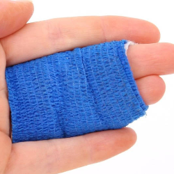 Tips Mencegah Luka Bakar di Rumah