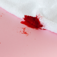 Mimisan pada Anak, Kenali Penyebab dan Penanganannya