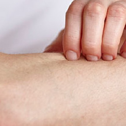 Minyak Kelapa Bisa Mengurangi Gejala Psoriasis