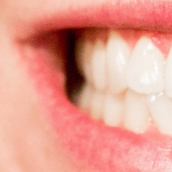 Cara Mengatasi Sakit Gigi di Malam Hari