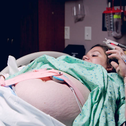 Sudah Trimester Dua Masih Muntah Hebat, Apakah Berbahaya?