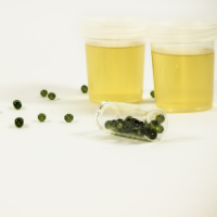 Obat-obatan yang Dapat Mengubah Warna Urine